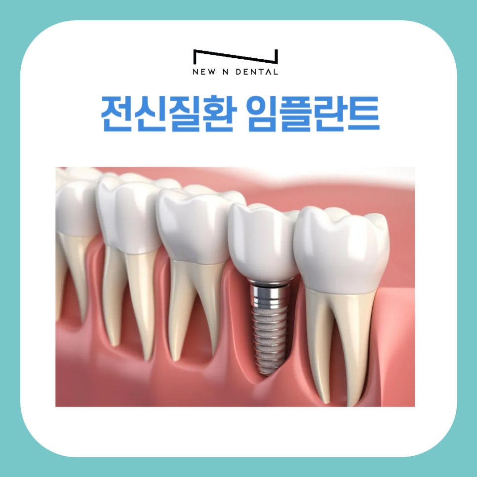 전신질환 환자도 임플란트 할 수 있을까? 안전한 치료방법 관련 이미지 1