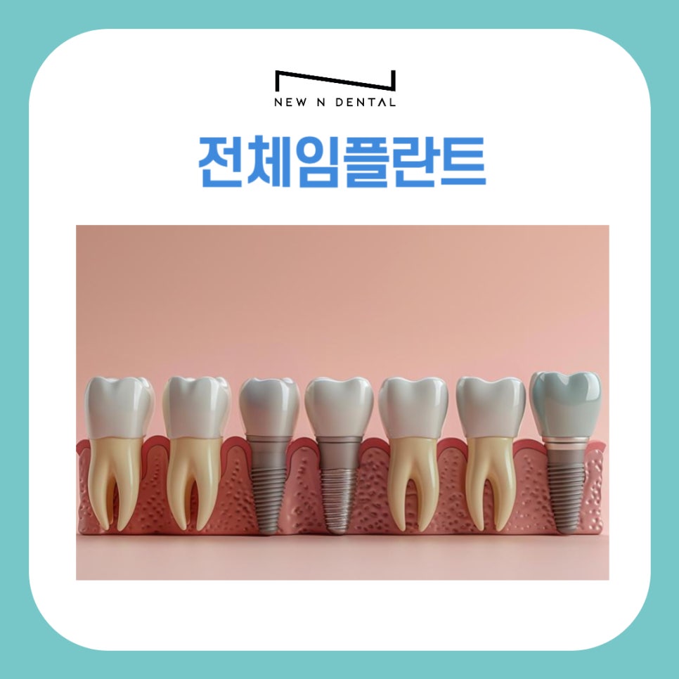 강남 전체임플란트 틀니 생각하고 있다면 관련 이미지 2