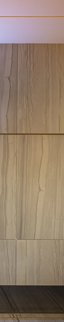 앞니심미치료로 되찾는 자연스러운 스마일 라인 관련 이미지 21