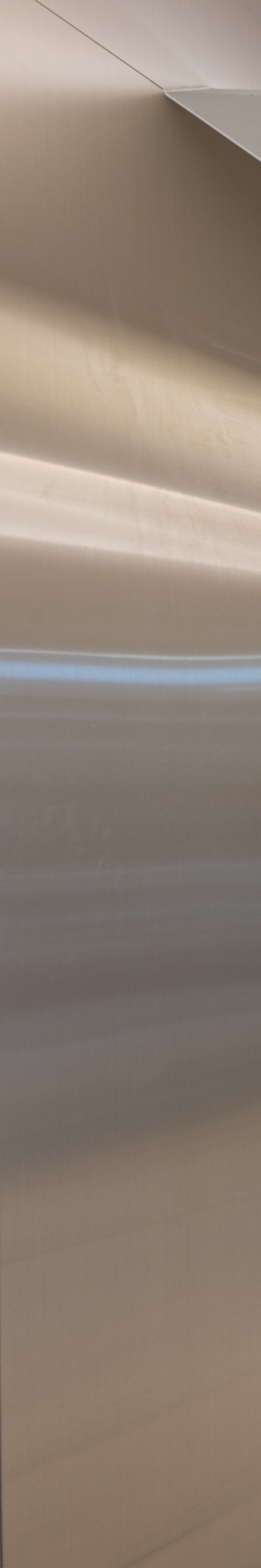 강남역치아교정 완벽한 미소를 위한 여정 관련 이미지 25