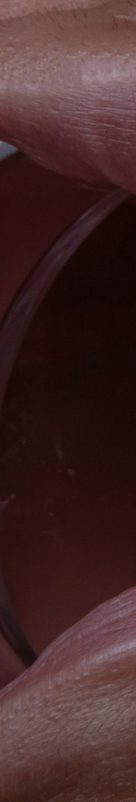 치아 미백 효과와 부작용 체크해야 할 사항 관련 이미지 20