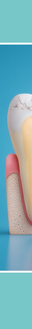 A Complete Guide to Implant Steps and Differences by Type at a Gangnam Station Dental Clinic image 12