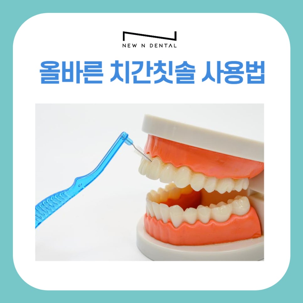 The Right Way to Use an Interdental Brush! Helping with Tooth Care image 1