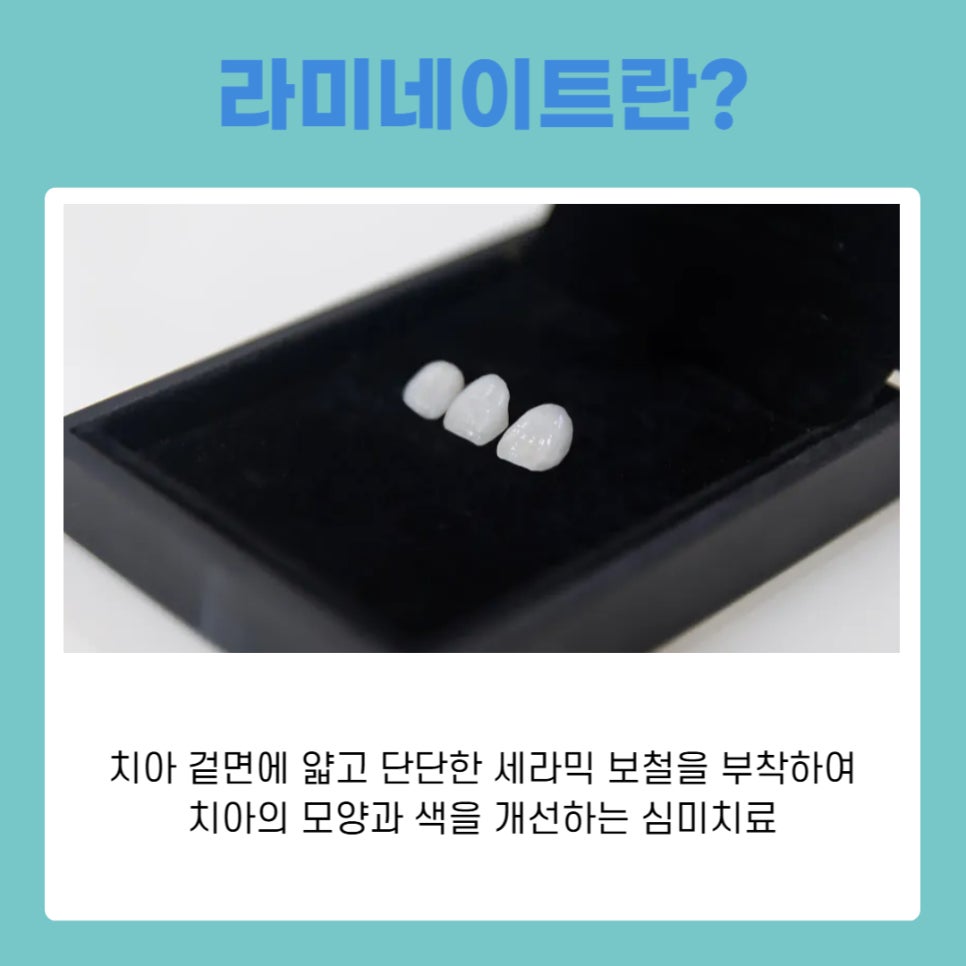 강남역치과 라미네이트 방법, 단계별로 알아보기 관련 이미지 3