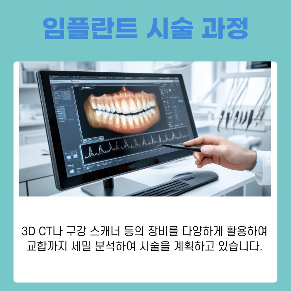 강남역치과 임플란트 시행하는 원인과 고려할 사항 관련 이미지 7