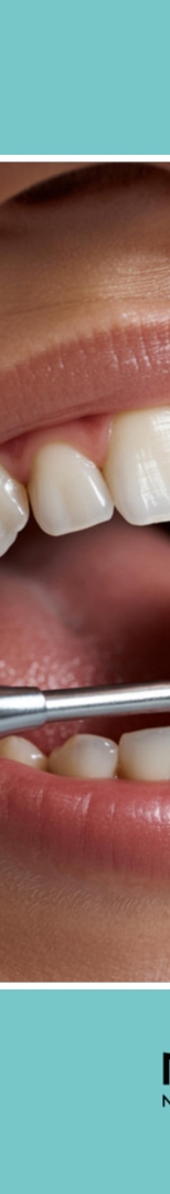 Seocho-dong Dental Clinic: Dental Regular Checkups and How to Prevent Cavities Properly image 12