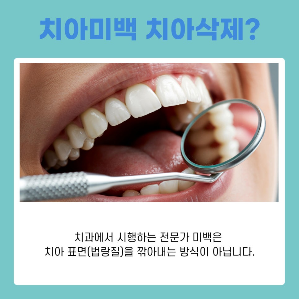 강남역 치아미백 원데이로 완성하는 환한 첫인상의 비밀 관련 이미지 8