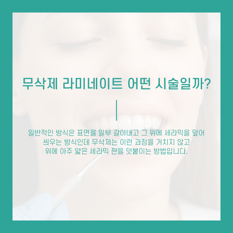 무삭제 라미네이트 저도 받을 수 있을까요? 관련 이미지 3