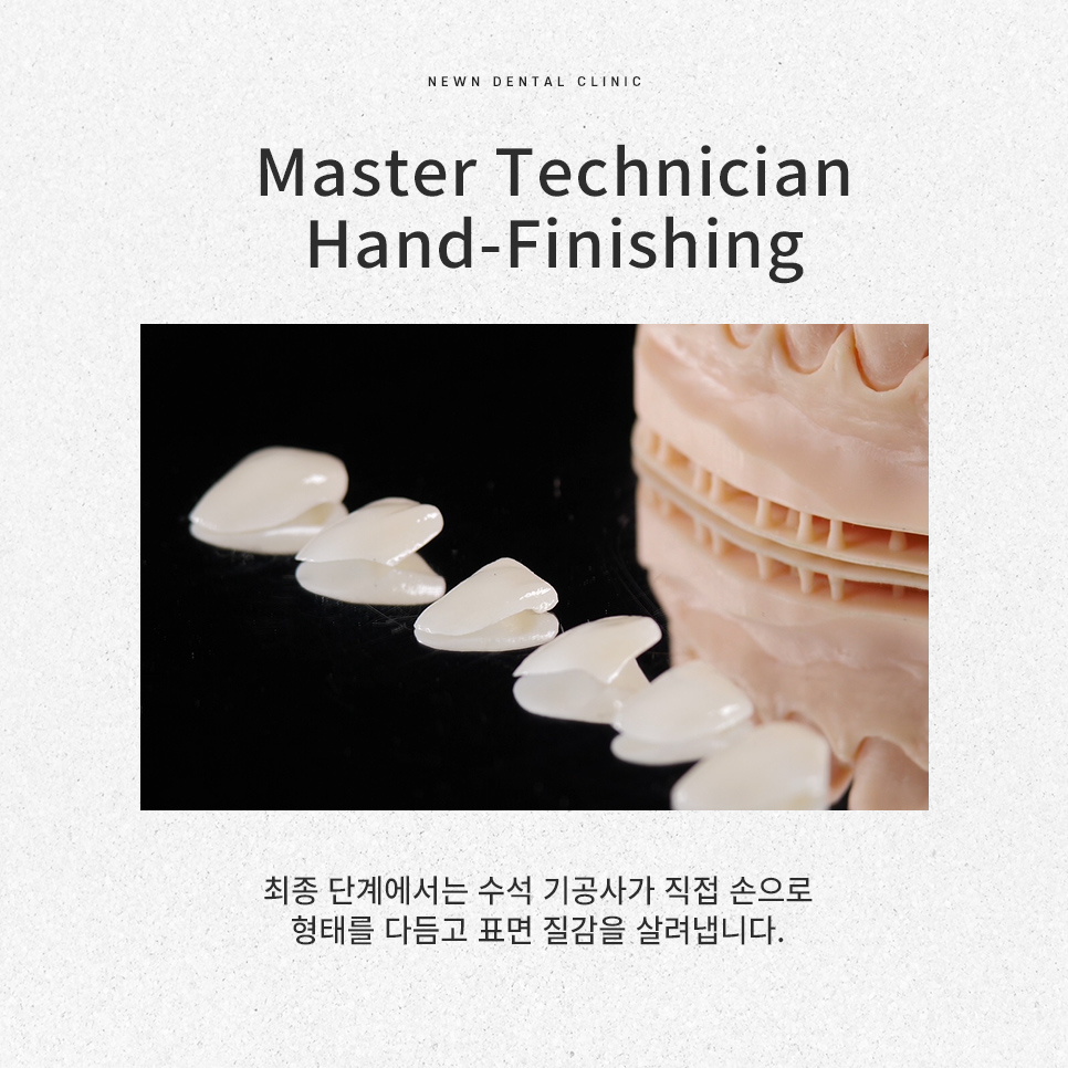 퍼스널라미 네츄럴ㅣ자연스러운 미소를 찾아주는 앞니성형, 무삭제 라미네이트 관련 이미지 9