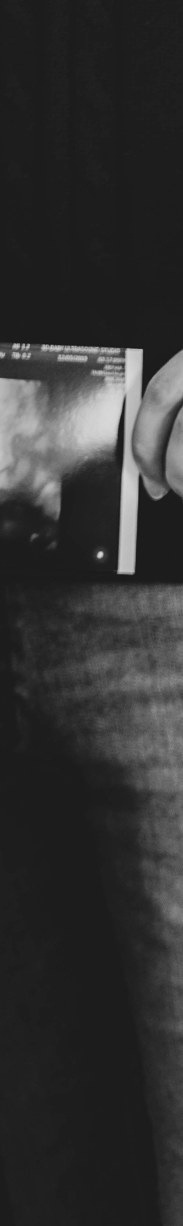 임산부 치아 건강 관리법 미리 알아두기 관련 이미지 25