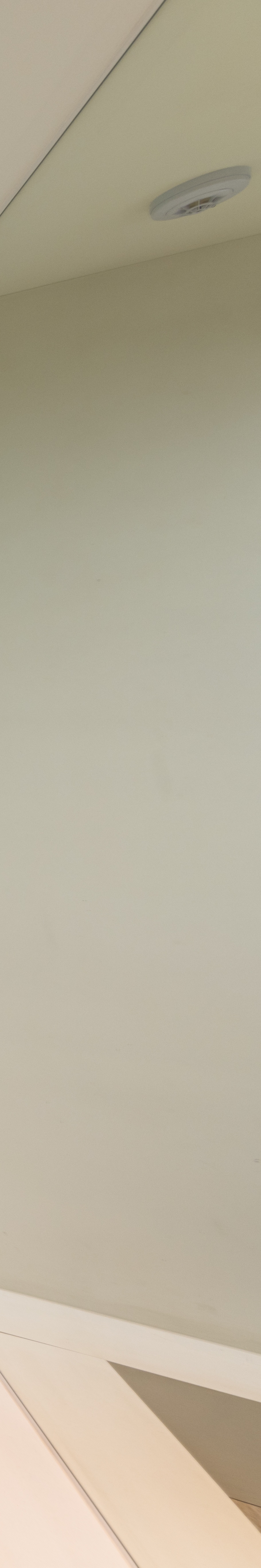 강남치아교정잘하는곳 자신감 넘치는 미소의 시작 관련 이미지 33