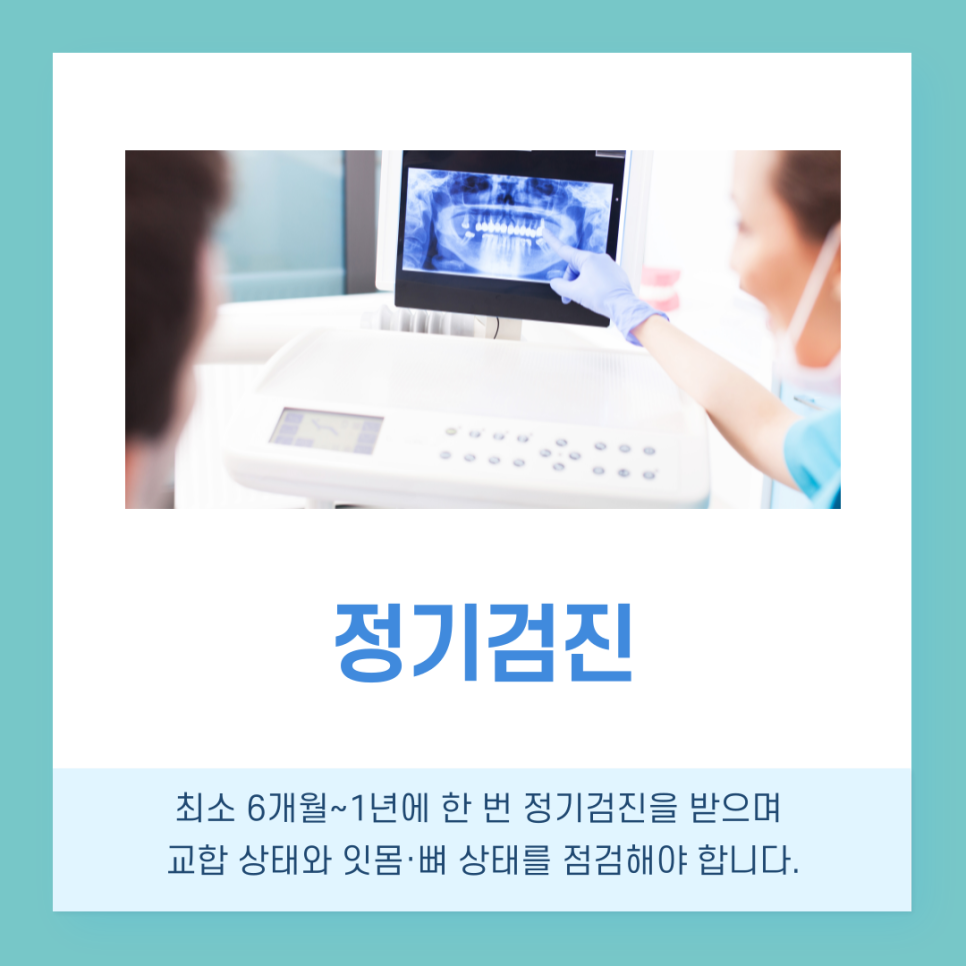강남역치과 임플란트 수명 얼마나 사용할 수 있을까? 관련 이미지 7