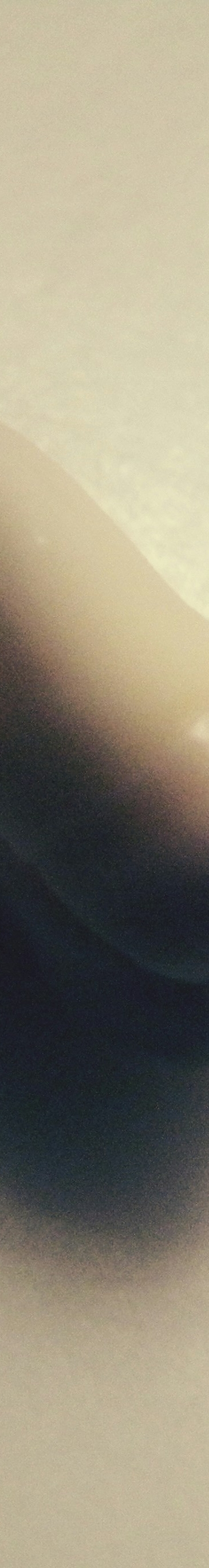 사랑니 발치 전 후 관리법 꿀팁 관련 이미지 24