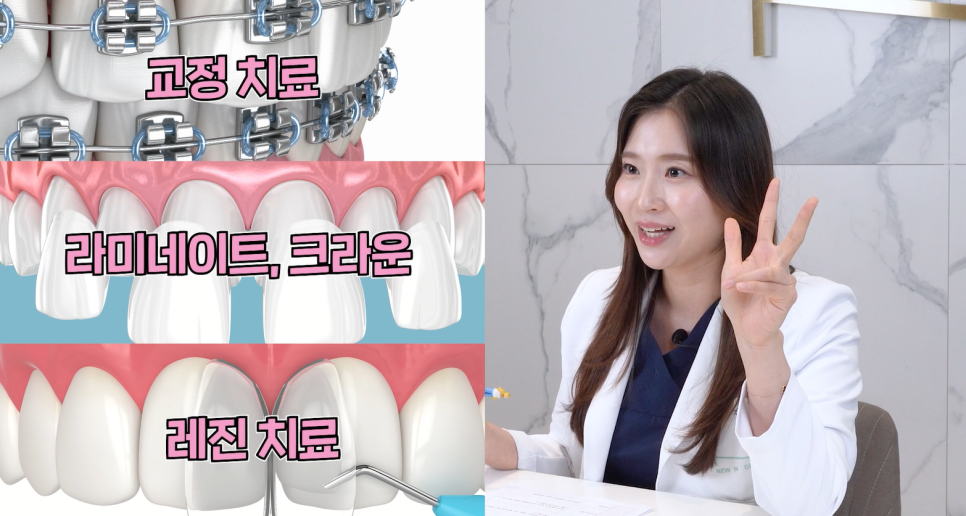 앞니 벌어짐 치료의 원인과 치료 방법 관련 이미지 10