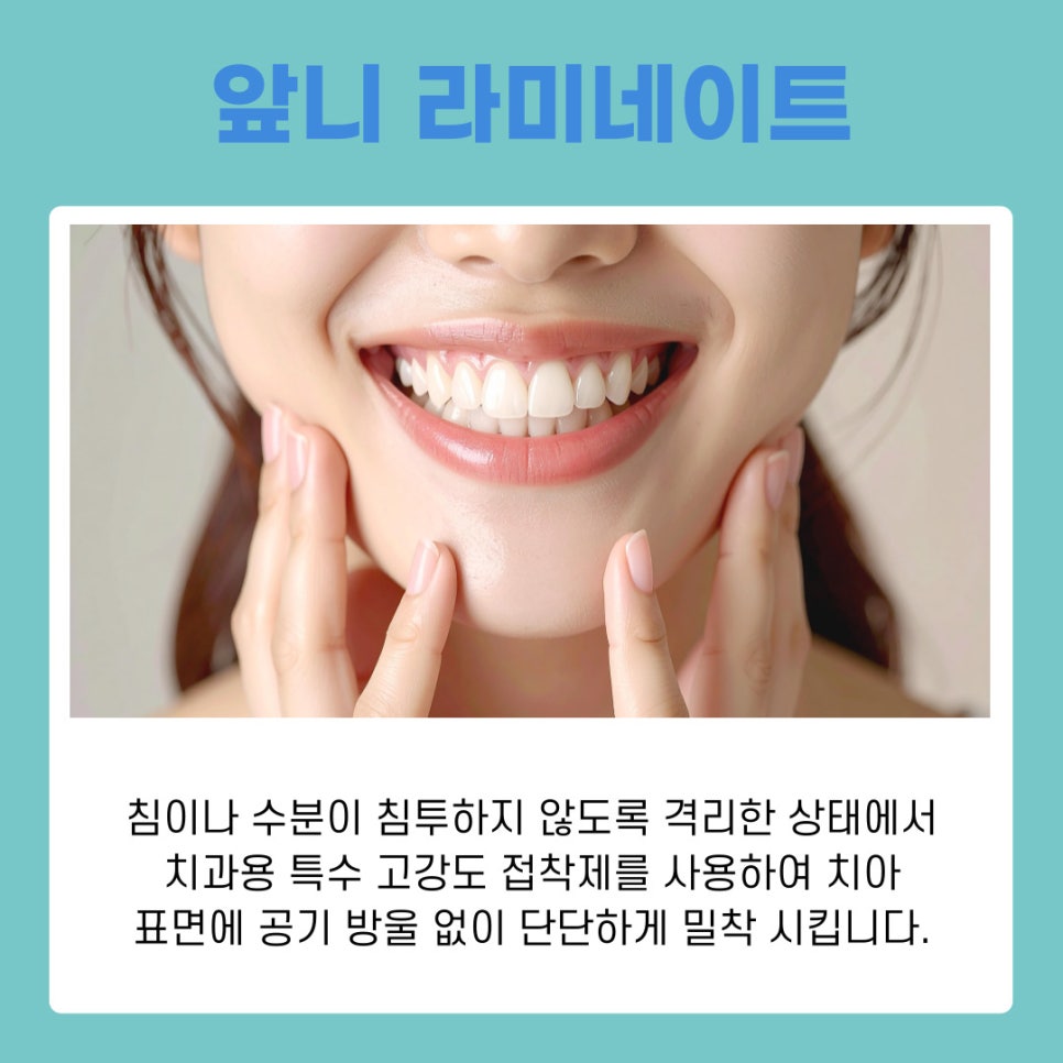 Smile Design Completed with Front Teeth Veneers image 9