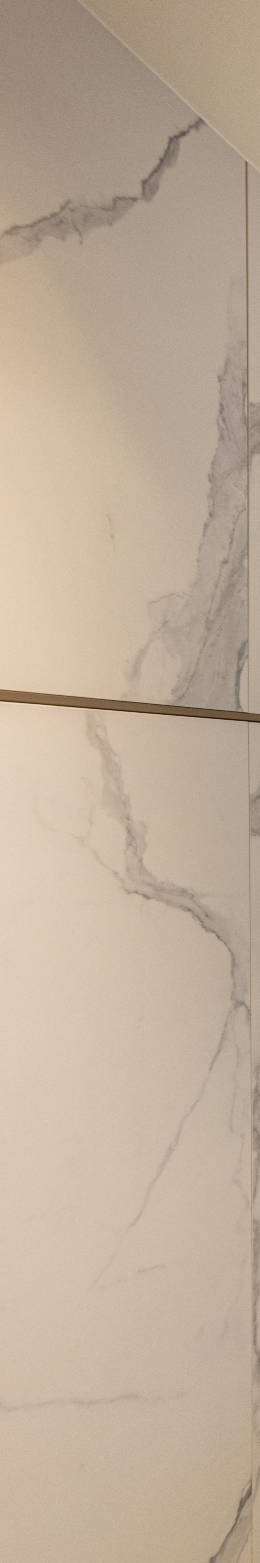 강남역충치치과 아프기 전에 미리 검진 받아야 관련 이미지 31