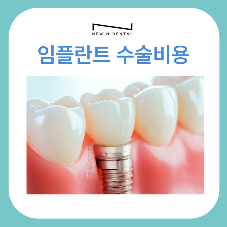 임플란트수술비용과 치료 과정에 대한 정보 관련 이미지 1