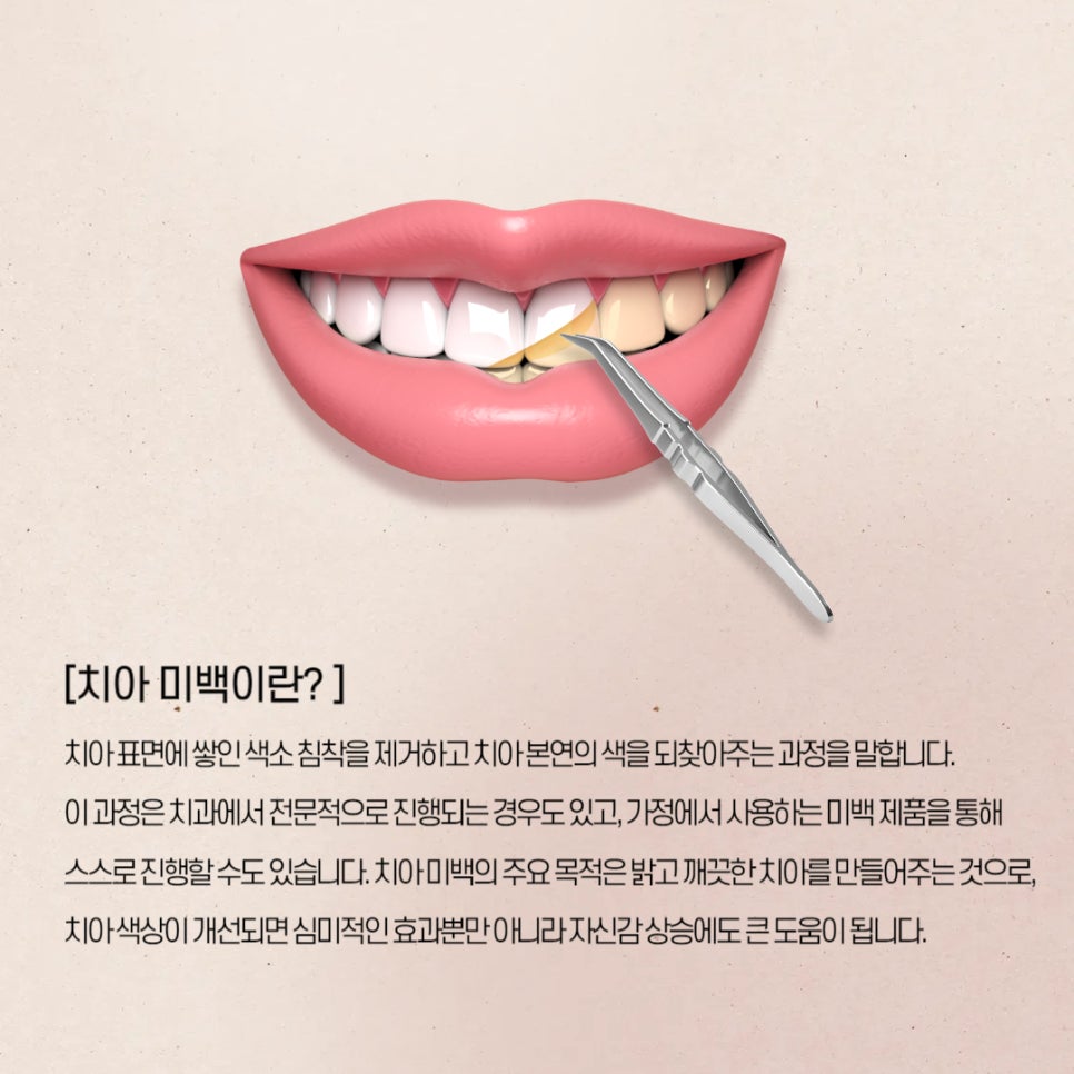 치아 미백 효과와 부작용 체크해야 할 사항 관련 이미지 2