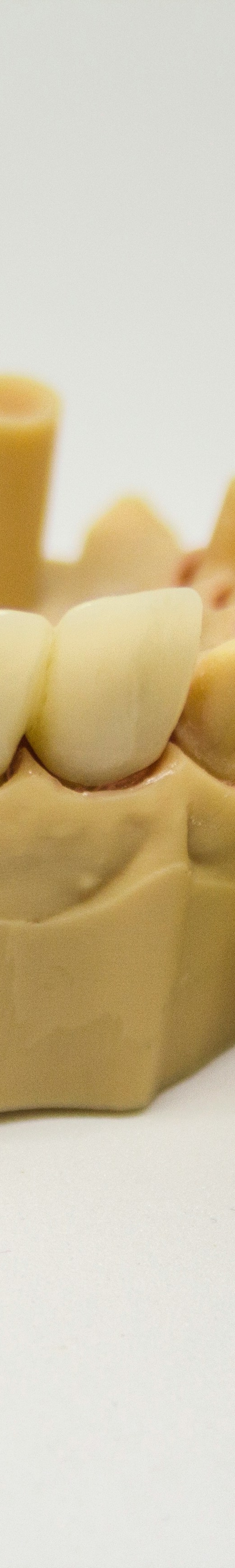 임플란트 후 관리의 중요성 관련 이미지 23