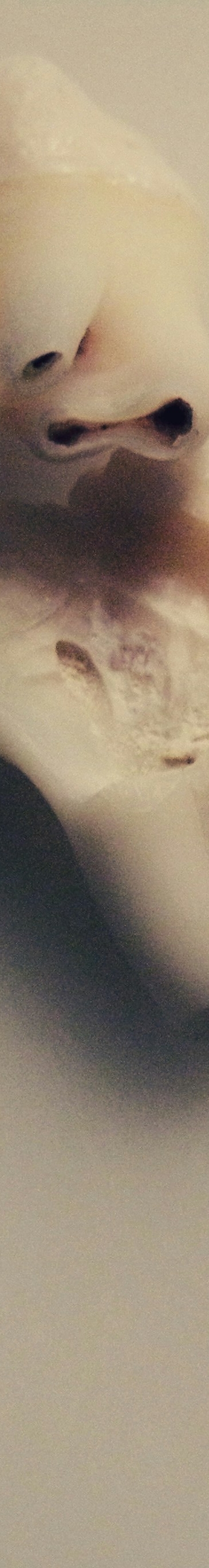 사랑니 발치 전 후 관리법 꿀팁 관련 이미지 20