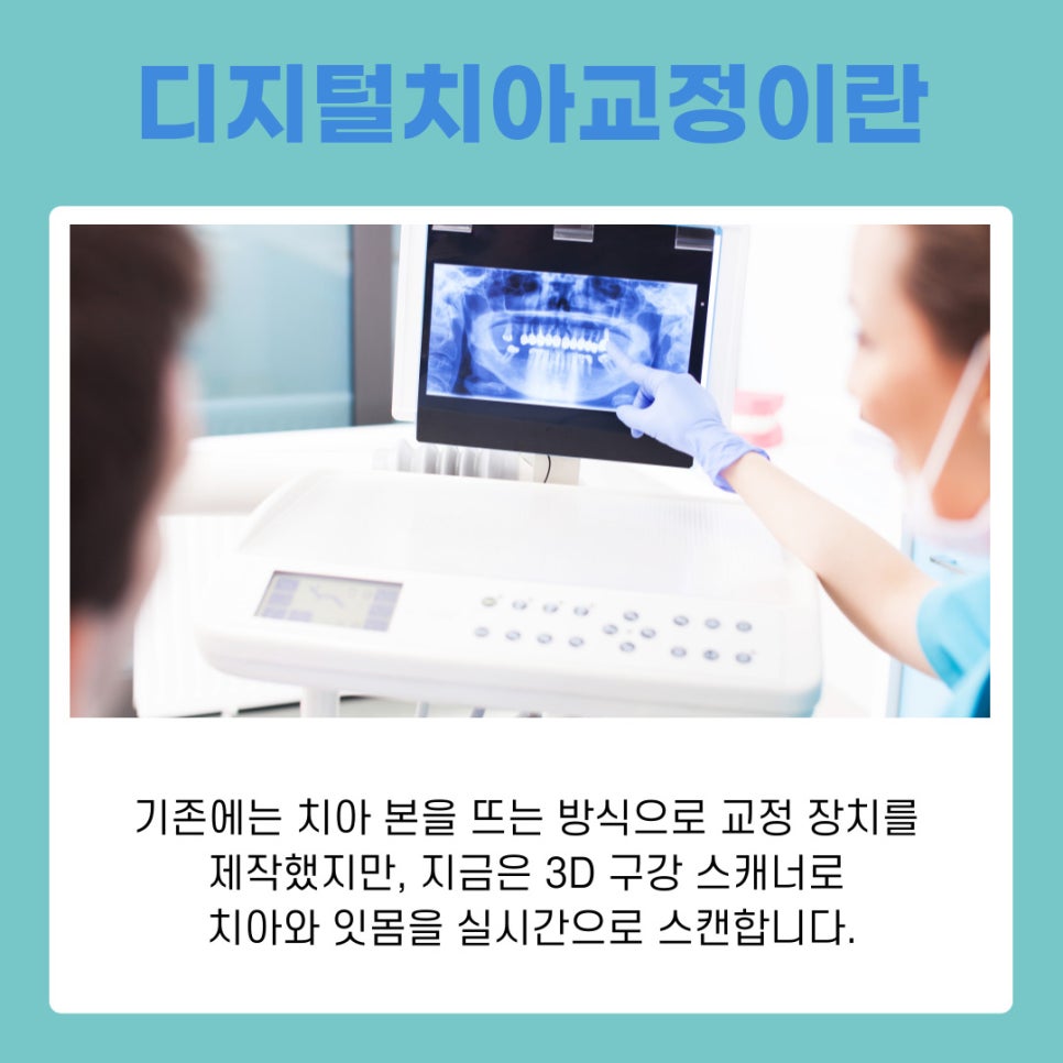 강남치아교정치과 치아교정방법, 디지털치아교정으로 더 정확하고 빠르게 관련 이미지 4