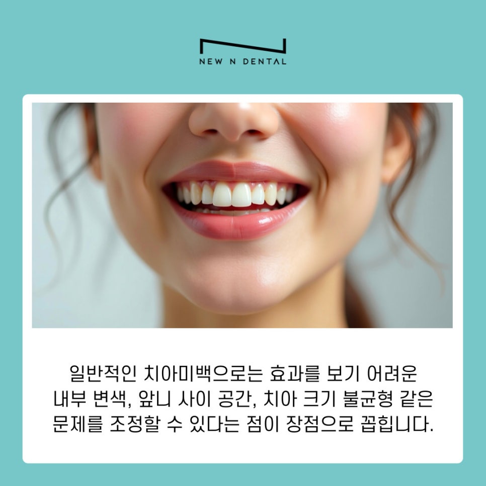 강남 논현동치과 치아미백 작용 원리와 유지 관리 방법 정리 관련 이미지 5