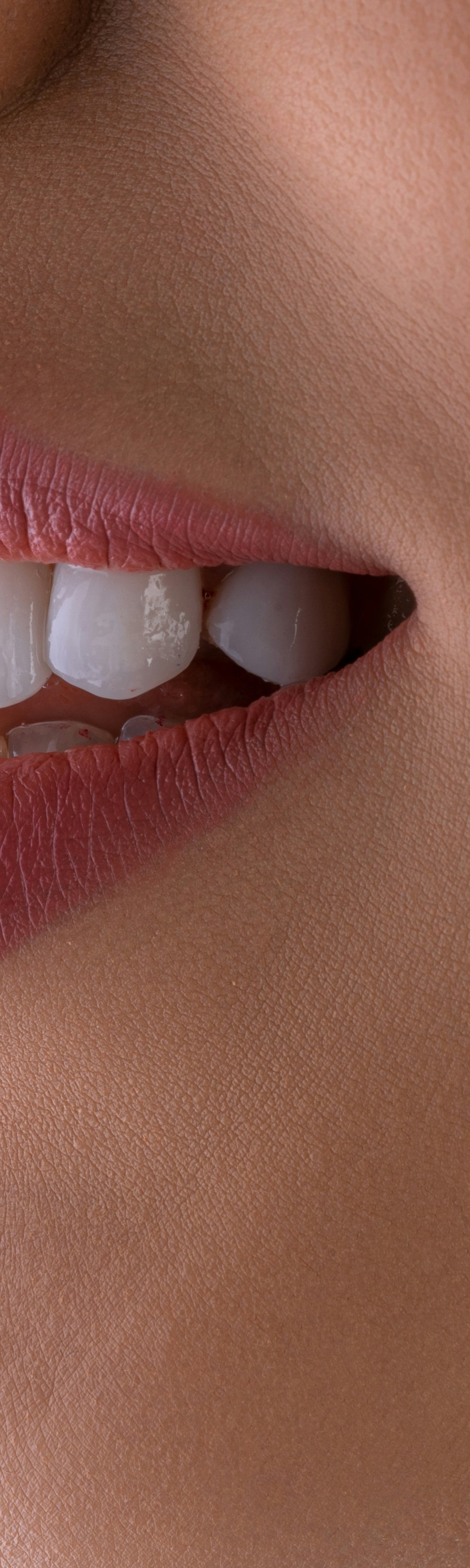 투명교정으로 치아 변화를 위해 관련 이미지 11