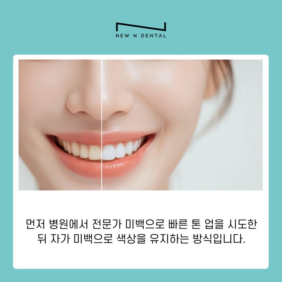 강남역 치아미백 누런니 고민해결 밝은 미소 되찾는 법 관련 이미지 6