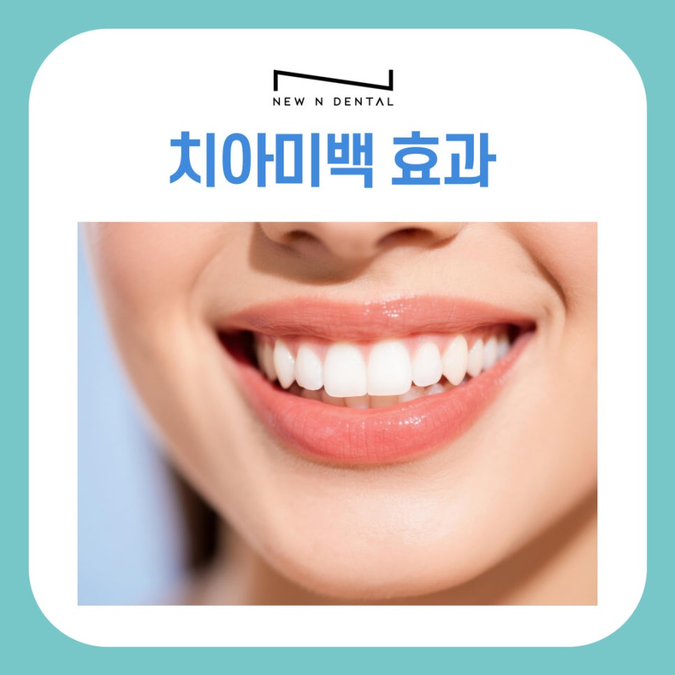 삼성동 치아미백 효과 오래 유지하는법 관련 이미지 2