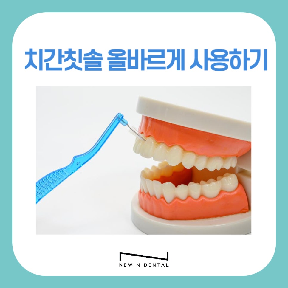 치간칫솔 치아관리 올바르게 사용하려면 관련 이미지 1