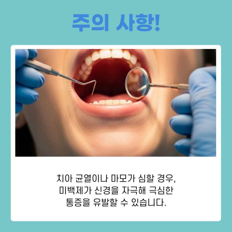 치과 치아미백의 원리부터 종류별 특징까지 완벽 가이드 관련 이미지 7