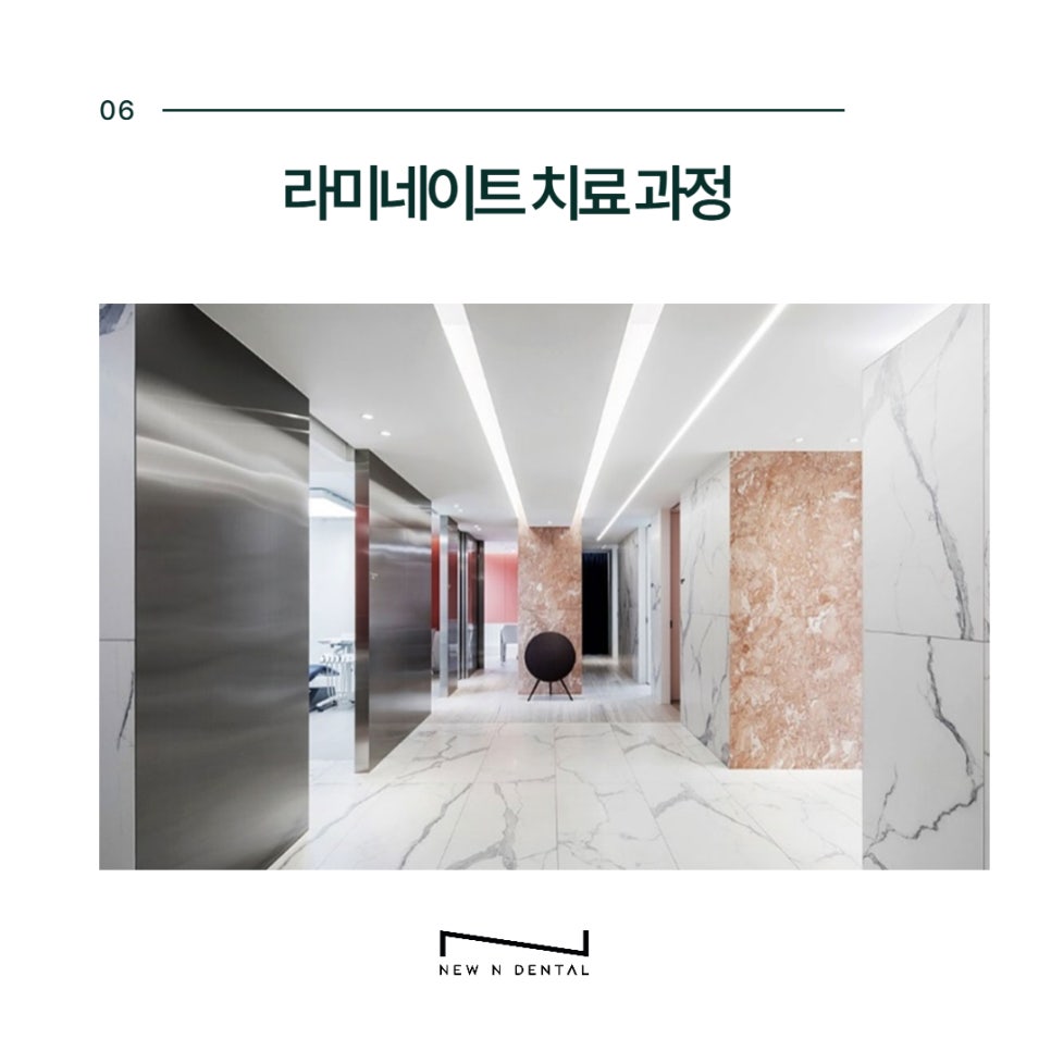 Non-Prep Veneer Cost at a Dental Clinic Near Sinnonhyeon Station image 7