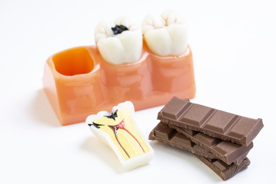 강남역충치치료 미루면 더 커지는 치아 문제 관련 이미지 5