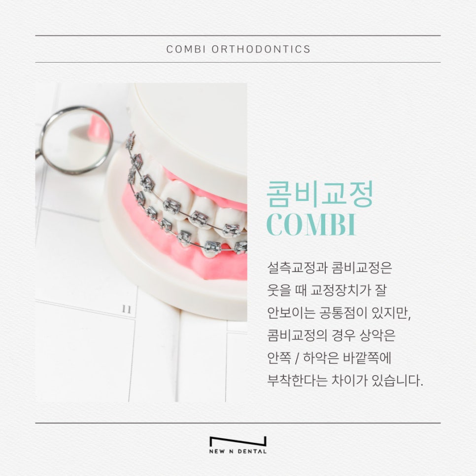 부정교합교정비용 결정 전 확인해야 할 사항 관련 이미지 7