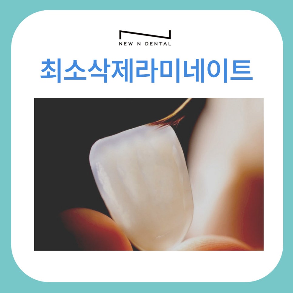 자연치아를 최대한 보호하는 최소삭제라미네이트 관련 이미지 1