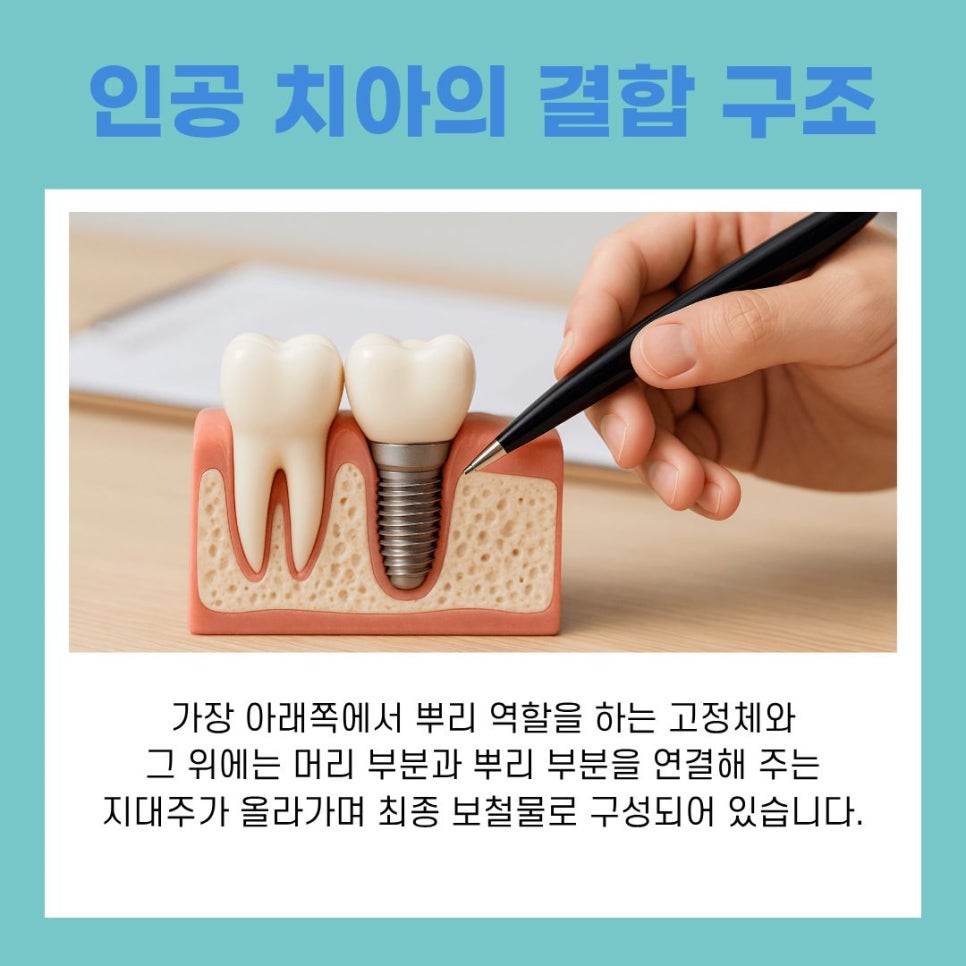 Dental Implant Surgery Process and Care Methods at Gangnam Station image 6
