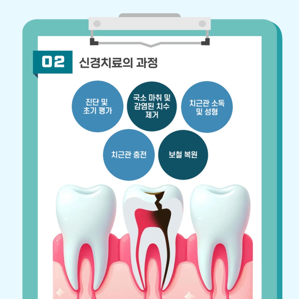 신경치료로 치아를 지키는 방법 관련 이미지 4
