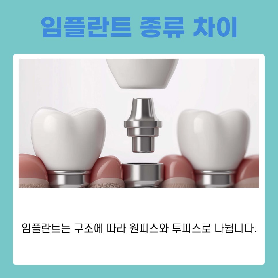 A Complete Guide to Implant Steps and Differences by Type at a Gangnam Station Dental Clinic image 6