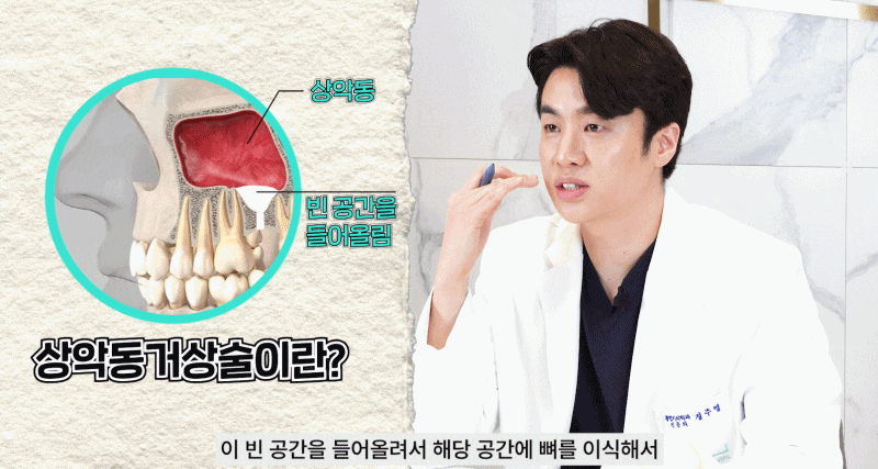 논현역치과 상악동거상술 어떤 치료일까 관련 이미지 3