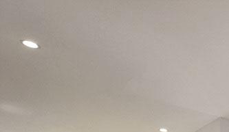 치아 지르코니아 크라운 중요한 요소 관련 이미지 17