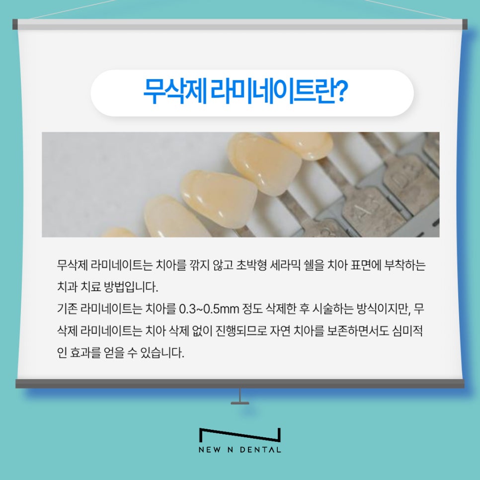 강남역치과 무삭제라미네이트 자신있게 관련 이미지 2