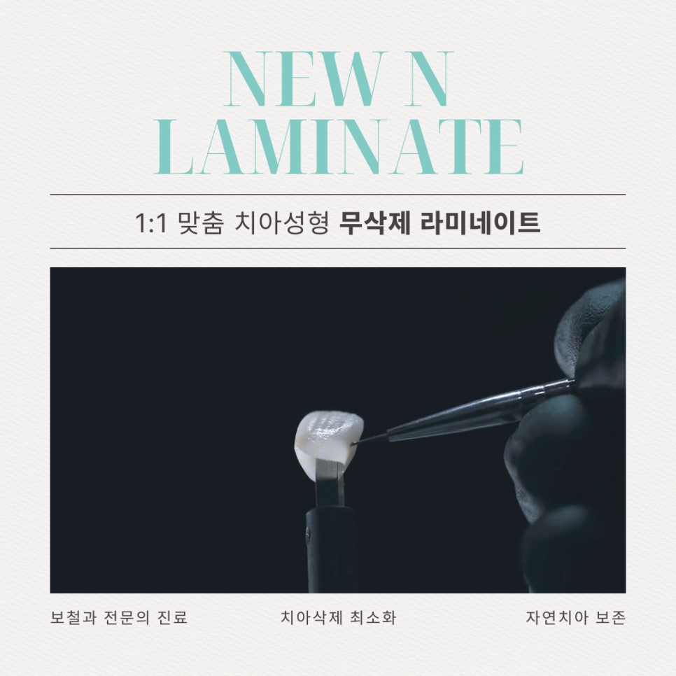 자연치아를 최대한 보호하는 최소삭제라미네이트 관련 이미지 5