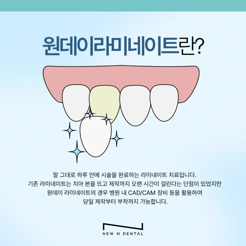 원데이 라미네이트 이런 분들께 추천드립니다 관련 이미지 3