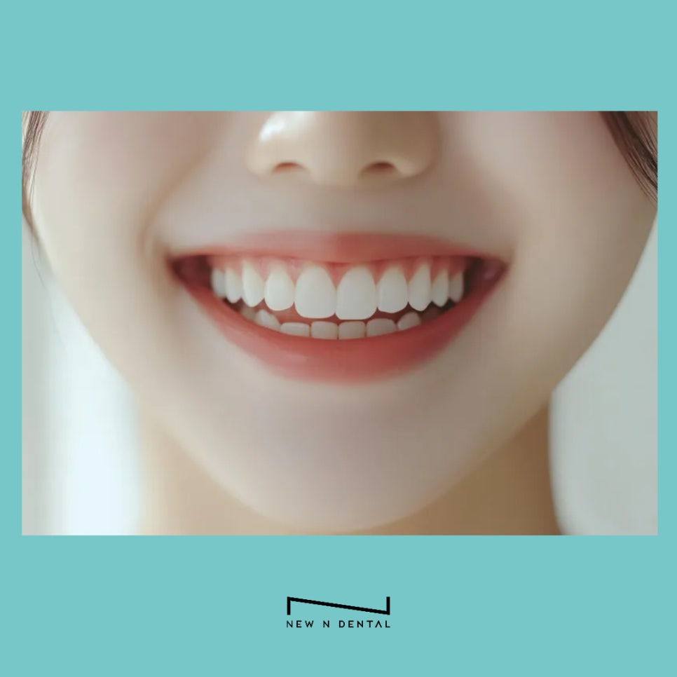 원데이 치아미백 변색의 원인과 후유증 없는 찐후기 관련 이미지 8