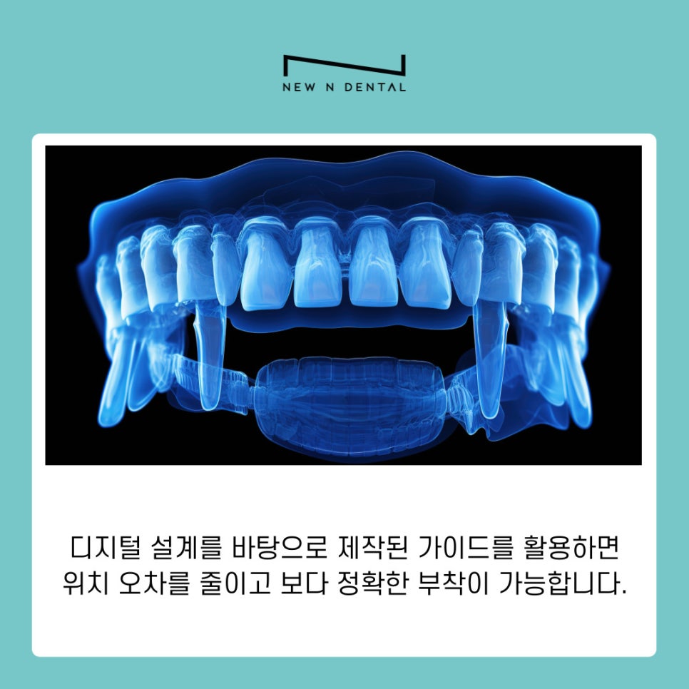 디지털교정 기존 치료와 무엇이 다를까 관련 이미지 5