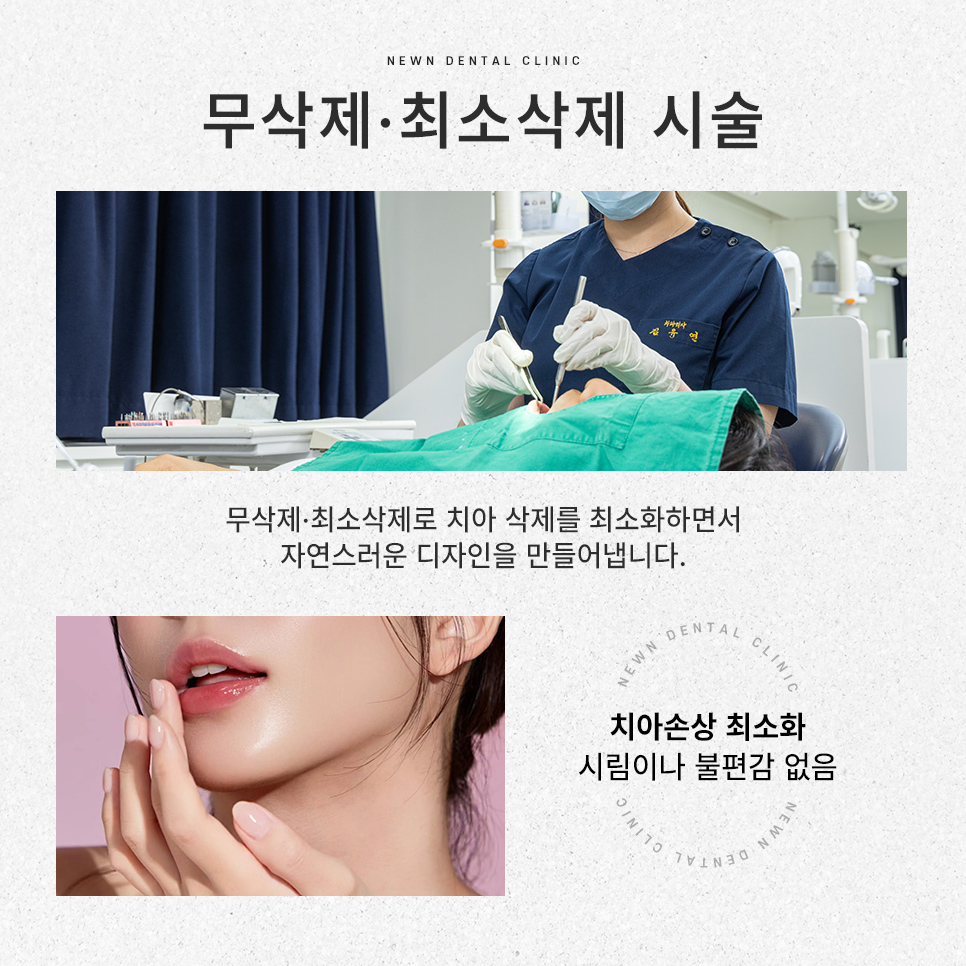 퍼스널라미 네츄럴ㅣ자연스러운 미소를 찾아주는 앞니성형, 무삭제 라미네이트 관련 이미지 6