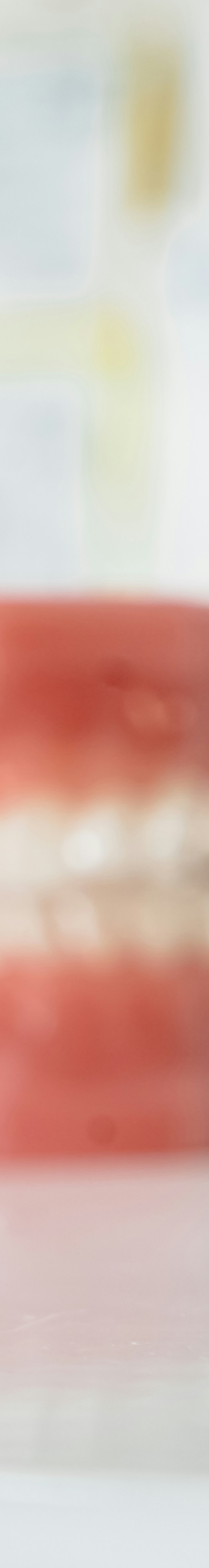 치아교정 종류 장단점 알아보기 관련 이미지 11