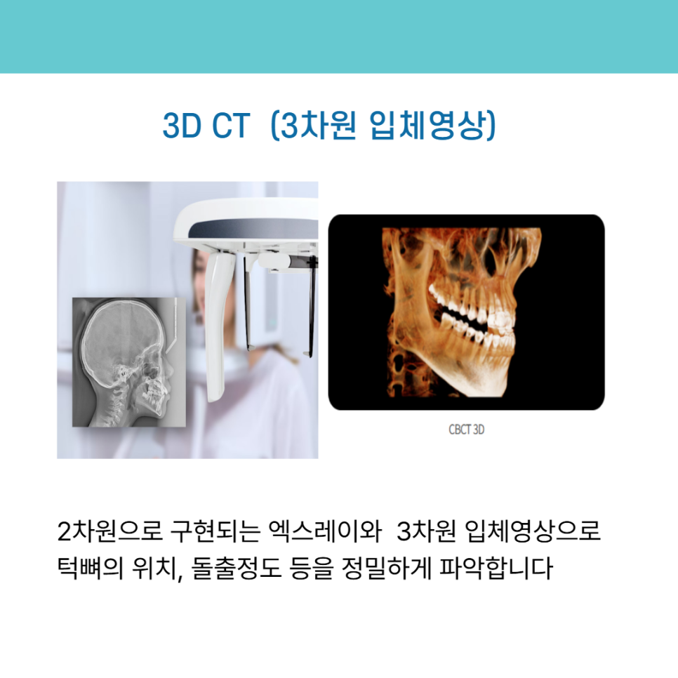 디지털 장비를 이용한 맞춤 치아 교정 관련 이미지 5