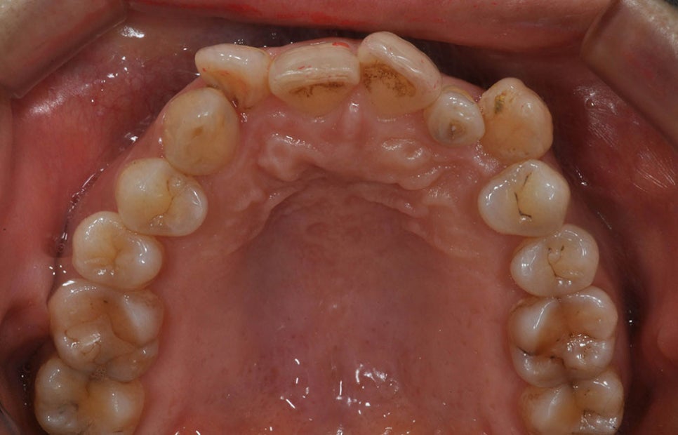 서초동치아교정잘하는곳 미세하고 우수하게 관련 이미지 4