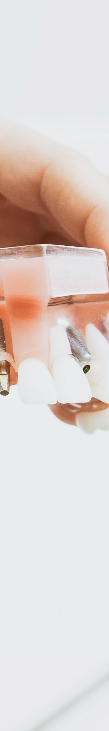 임플란트와 틀니 차이점, 나에게 맞는 선택은? 관련 이미지 20